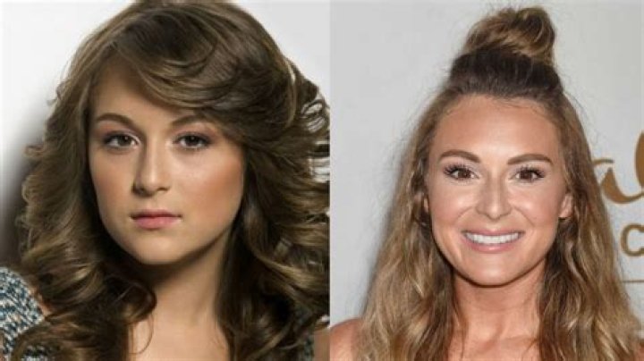Alexa PenaVega Plastic Surgery Before and After