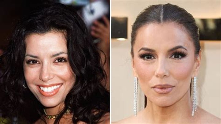 Eva Longoria Breast Augmentation Plastic Surgery Before and After