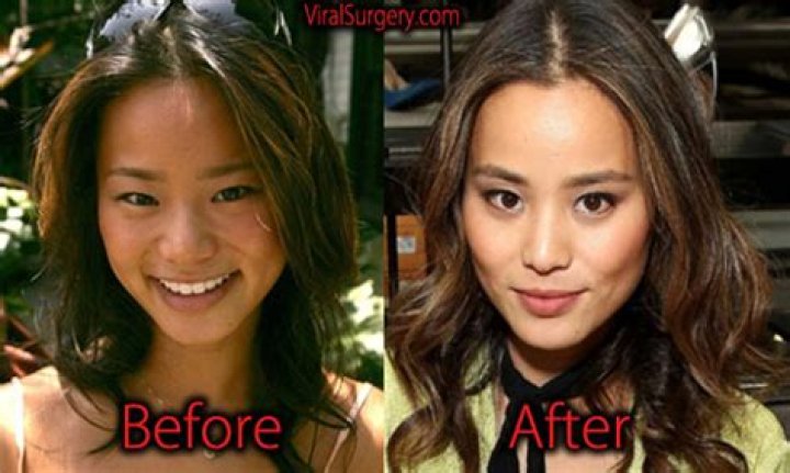 Jamie Chung Plastic Surgery Before and After