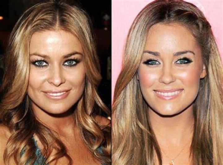 Lauren Conrad Plastic Surgery Before and After