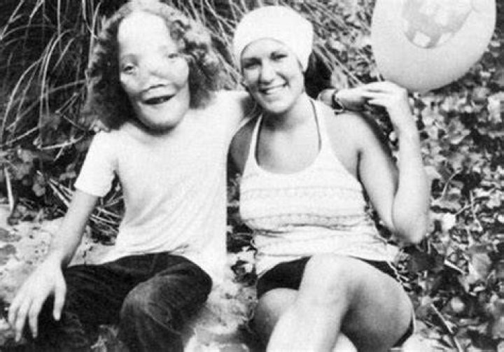 Rocky Dennis Rocky Dennis