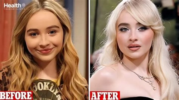 sabrina carpenter plastic surgery